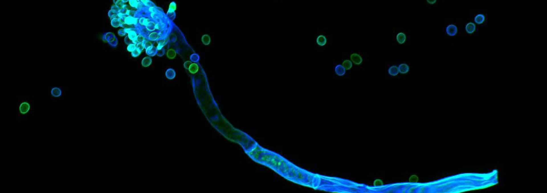Sporenträger von Aspergillus fumigatus, der Sporen (Konidien) erzeugt