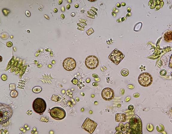 Phytoplankton: unterschiedlich geformte Einzeller unter dem Mikroskop