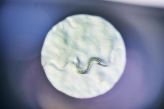 Mikroskopische Aufnahme des Fadenwurms