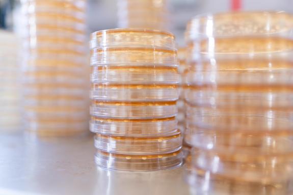 Mehrere Stapel von Petrischalen, in denen mikrobielle Kulturen punktförmig wachsen