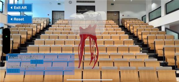 Mit VR-Brille ins Zahninnere blicken
