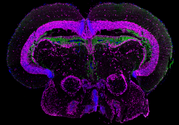 Querschnittsbild des Mittelhirns eines Killifisches. Blau kennzeichnet den Nukleus, Magenta die neuronalen Zellkerne und Grün die Astrozyten.