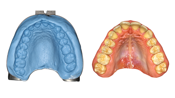 From ‘play dough’ to a 3D scan 