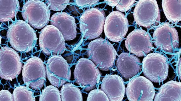 Ein Ungleichgewicht im vaginalen Mikrobiom erhöht das Risiko für sexuell übertragbar Erkrankungen wie den Tripper (Gonorrhoe), der durch Neisseria gonorrhoeae Bakterien (Foto) verursacht wird.