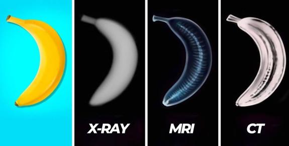 Bananas in medical imaging