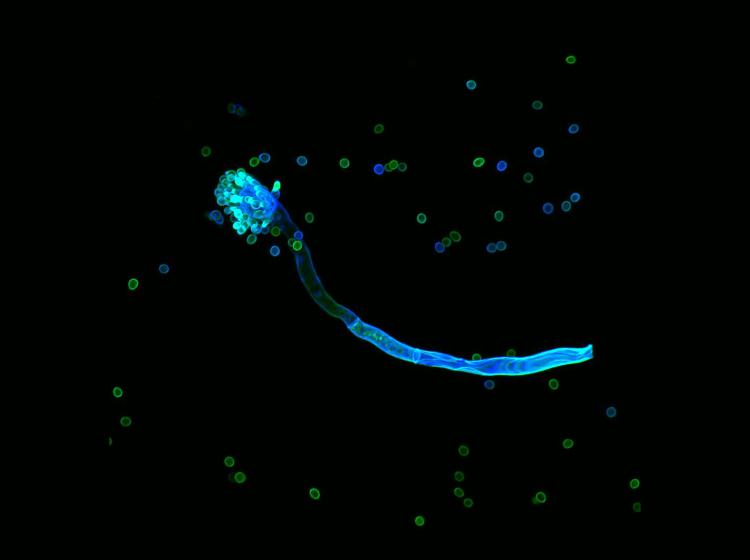 Sporenträger von Aspergillus fumigatus, der Sporen (Konidien) erzeugt